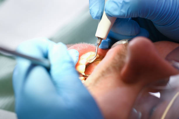 Best Emergency Gum Treatment in Panthersville, GA